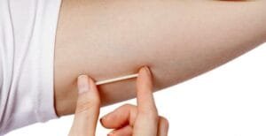 ما هي كبسولة منع الحمل