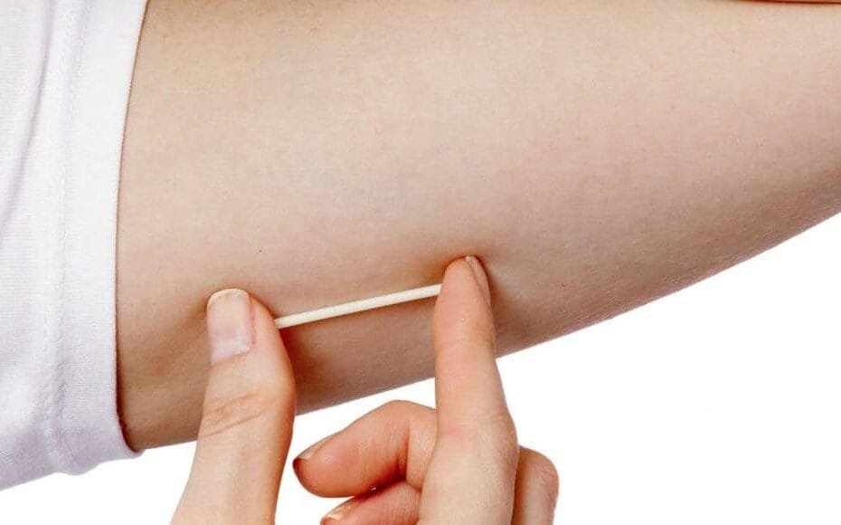 ما هي كبسولة منع الحمل