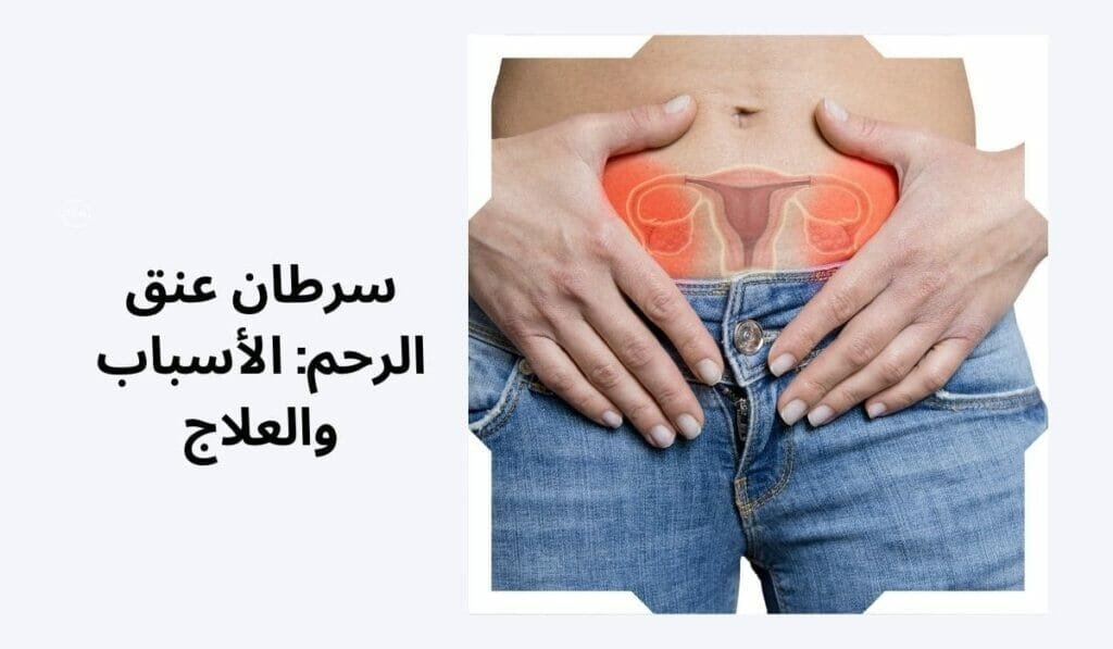 سرطان عنق الرحم: الأسباب والعلاج