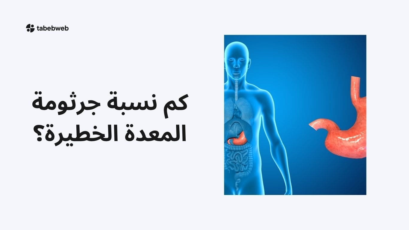 كم نسبة جرثومة المعدة الخطيرة؟