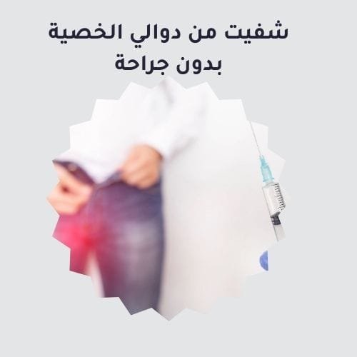 شفيت من دوالي الخصية بدون جراحة