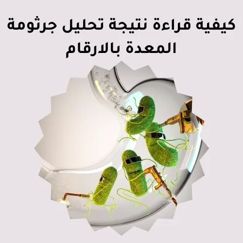 كيفية قراءة نتيجة تحليل جرثومة المعدة بالارقام